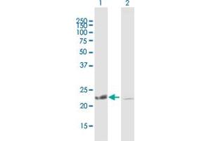 Western Blot analysis of COMMD1 expression in transfected 293T cell line by COMMD1 MaxPab polyclonal antibody. (COMMD1 Antikörper  (AA 1-190))