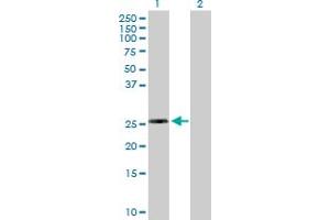 Western Blot analysis of RPL10L expression in transfected 293T cell line by RPL10L MaxPab polyclonal antibody. (RPL10L Antikörper  (AA 1-214))