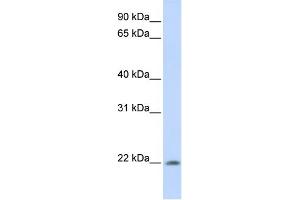 WB Suggested Anti-C2orf28 Antibody Titration: 0. (ATRAID Antikörper  (C-Term))