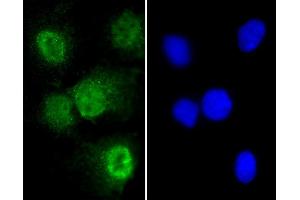 Immunofluorescent analysis of 4 % paraformaldehyde-fixed, 0. (T Antigen (AA 15-43), (N-Term) Antikörper)