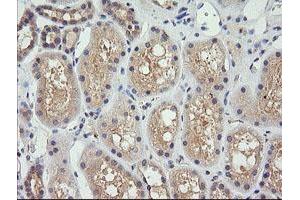 Image no. 1 for anti-Cancer/testis Antigen 1B (CTAG1B) antibody (ABIN1499892) (CTAG1B Antikörper)
