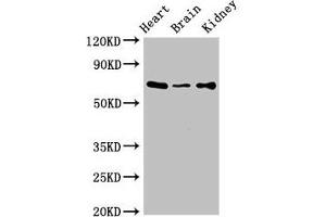 Western Blot Positive WB detected in: Mouse heart tissue, Mouse brain tissue, Mouse kidney tissue All lanes: SLC6A13 antibody at 3 μg/mL Secondary Goat polyclonal to rabbit IgG at 1/50000 dilution Predicted band size: 69, 58, 11 kDa Observed band size: 69 kDa (SLC6A13 Antikörper  (AA 1-40))