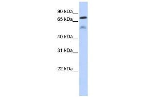 DUSP8 antibody used at 1 ug/ml to detect target protein. (DUSP8 Antikörper  (Middle Region))