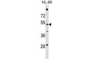 T161A Antibody (N-term) (ABIN1881865 and ABIN2839083) western blot analysis in HL-60 cell line lysates (35 μg/lane). (TMEM161A Antikörper  (N-Term))