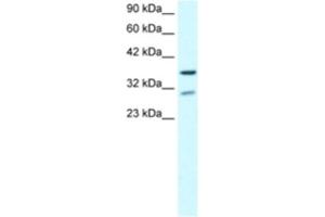 Western Blotting (WB) image for anti-Zinc Finger Protein 385A (ZNF385A) antibody (ABIN2460497)