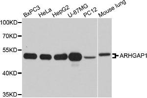 Western blot analysis of extracts of various cells, using ARHGAP1 antibody. (ARHGAP1 Antikörper)