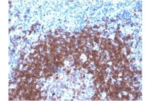 ABIN6383859 to CD79a was successfully used to stain human tonsil sections. (Rekombinanter CD79a Antikörper  (AA 202-216))