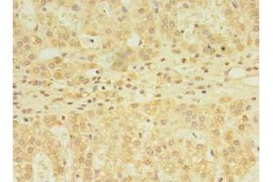Immunohistochemistry of paraffin-embedded human adrenal gland tissue using ABIN7171119 at dilution of 1:100