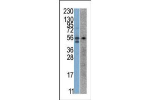 The anti-STK38 Pab is used in Western blot to detect STK38 in SK-Br-3 (left) and Jurkat (right) cell line lysates.