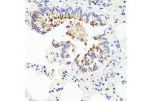 Immunohistochemistry of paraffin-embedded rat lung using FLI20294 antibody at dilution of 1:100 (x40 lens).