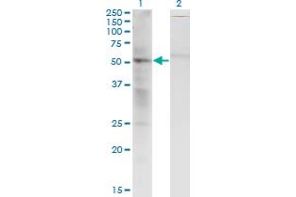 SS18 Antikörper  (AA 116-216)
