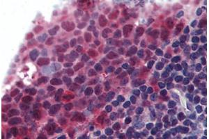 Human Tonsil (formalin-fixed, paraffin-embedded) stained with TNFSF13B antibody ABIN295930 at 10 ug/ml followed by biotinylated goat anti-rabbit IgG secondary antibody ABIN481713, alkaline phosphatase-streptavidin and chromogen. (BAFF Antikörper  (AA 254-269))