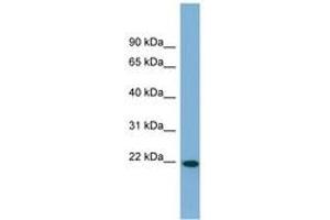 Image no. 1 for anti-Fibronectin Type III Domain Containing 4 (FNDC4) (AA 71-120) antibody (ABIN6742082) (FNDC4 Antikörper  (AA 71-120))