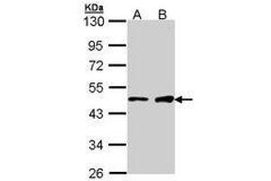 Image no. 1 for anti-GATA Binding Protein 1 (Globin Transcription Factor 1) (GATA1) (AA 28-236) antibody (ABIN467586) (GATA1 Antikörper  (AA 28-236))