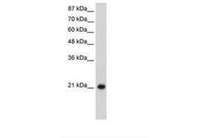 Image no. 1 for anti-Ribosomal Protein L9 (RPL9) (C-Term) antibody (ABIN203025) (RPL9 Antikörper  (C-Term))