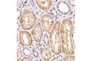 Immunohistochemistry of paraffin embedded human kidney using Clcn5 (ABIN7073471) at dilution of 1:200 (400x lens) (Chloride Channel 5 Antikörper)