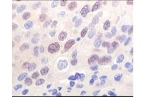 Immunohistochemistry (IHC) image for anti-K(lysine) Acetyltransferase 8 (KAT8) (truncated) antibody (ABIN2464086) (MYST1 Antikörper  (truncated))