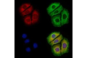 Arc Antibody staining Hela cells by IF/ICC. (Arc Antikörper  (Internal Region))