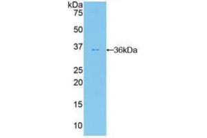 Western blot analysis of recombinant Human PKBb. (AKT2 Antikörper  (AA 142-412))
