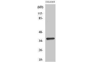 Western Blotting (WB) image for anti-Olfactory Receptor, Family 4, Subfamily A, Member 15 (OR4A15) (C-Term) antibody (ABIN3176539) (OR4A15 Antikörper  (C-Term))