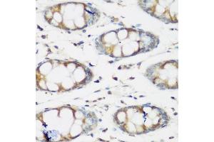 Immunohistochemistry of paraffin-embedded human colon using BMP2 antibody (ABIN5970060) at dilution of 1/200 (40x lens). (BMP2 Antikörper)