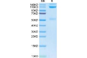 CD51/CD61 Protein (AA 31-992) (Fc Tag)