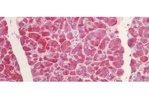 Immunohistochemistry (IHC) image for anti-Fibrinogen-Like 1 (FGL1) (AA 23-314) antibody (ABIN7438670)