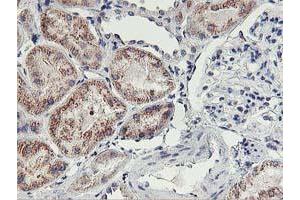 Immunohistochemical staining of paraffin-embedded Human Kidney tissue using anti-HOXC11 mouse monoclonal antibody. (HOXC11 Antikörper  (AA 1-304))