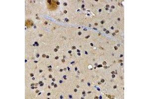 Immunohistochemical analysis of SATB1 staining in rat brain formalin fixed paraffin embedded tissue section.