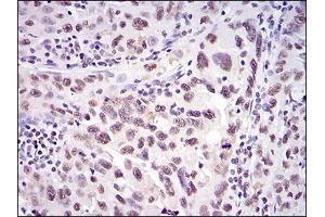 Immunohistochemistry (IHC) image for anti-X-Ray Repair Complementing Defective Repair in Chinese Hamster Cells 6 (XRCC6) (AA 6-214) antibody (ABIN5542547)