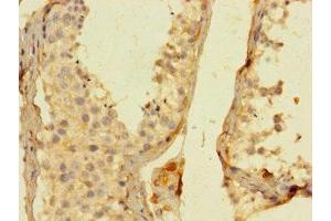 Immunohistochemistry of paraffin-embedded human testis tissue using ABIN7156163 at dilution of 1:100 (PLCL2 Antikörper  (AA 2-300))