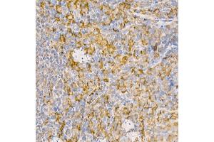 Immunohistochemistry of paraffin-embedded rat spleen using [KO Validated] RA Rabbit pAb (ABIN3021646, ABIN3021647, ABIN3021648 and ABIN1513457) at dilution of 1:100 (40x lens). (RAB5 Antikörper  (AA 1-215))