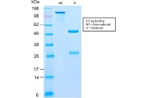 SDS-PAGE Analysis Purified BCL10 Recombinant Rabbit Monoclonal Antibody (BL10/2988R). (Rekombinanter BCL10 Antikörper  (AA 122-168))