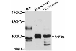 Western blot analysis of extracts of various cell lines, using RNF10 antibody (ABIN5998702) at 1/1000 dilution. (RNF10 Antikörper)