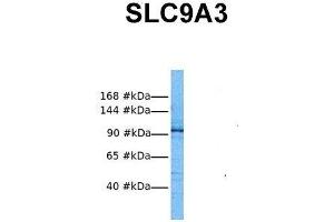 Host:  Rabbit  Target Name:  SLC9A3  Sample Tissue:  Human RPMI-8226  Antibody Dilution:  1. (SLC9A3 Antikörper  (Middle Region))
