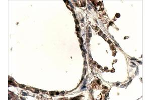 ABIN263200 (4µg/ml) staining of paraffin embedded Human Thyroid Gland. (DUOX1 Antikörper  (Internal Region))