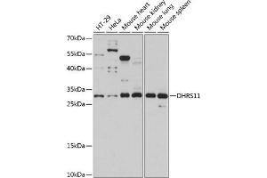 Western blot analysis of extracts of various cell lines, using DHRS11 antibody (ABIN7266723) at 1:1000 dilution. (DHRS11 Antikörper  (AA 1-260))