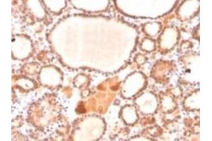 Immunohistochemistry (IHC) image for anti-Glyoxalase I (GLO1) antibody (ABIN6939533)