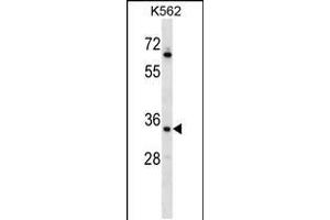 Western blot analysis in K562 cell line lysates (35ug/lane). (RAD1 Antikörper  (AA 118-146))