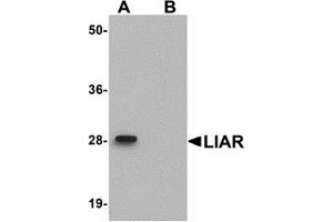 Western Blotting (WB) image for anti-Ankyrin Repeat Domain 54 (ANKRD54) (C-Term) antibody (ABIN1030482) (ANKRD54 Antikörper  (C-Term))