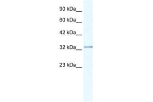 Western Blotting (WB) image for anti-Nudix (Nucleoside Diphosphate Linked Moiety X)-Type Motif 9 (NUDT9) antibody (ABIN2461167)
