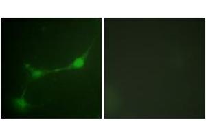 Immunofluorescence analysis of NIH-3T3 cells, using Ataxin 1 (Phospho-Ser776) Antibody. (Ataxin 1 Antikörper  (pSer776))