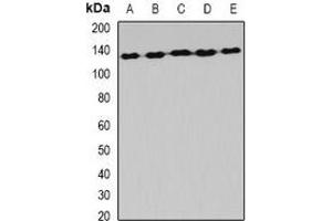 Western blot analysis of AlaRS expression in Hela (A), MCF7 (B), mouse liver (C), mouse brain (D), rat spinal cord (E) whole cell lysates. (AARS2 Antikörper)
