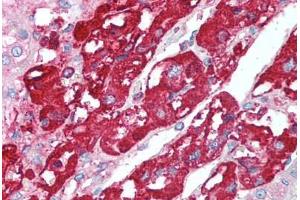 Human Adrenal (formalin-fixed, paraffin-embedded) stained with CHGA antibody ABIN214090 at 5 ug/ml followed by biotinylated goat anti-rabbit IgG secondary antibody ABIN481713, alkaline phosphatase-streptavidin and chromogen.