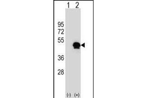 Western blot analysis of SERPINE1 (arrow) using rabbit polyclonal SERPINE1 Antibody (Center) (ABIN656843 and ABIN2846050). (PAI1 Antikörper  (AA 188-216))