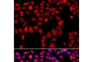 Immunofluorescence analysis of A549 cells using ARHGEF9 Polyclonal Antibody (Arhgef9 Antikörper)