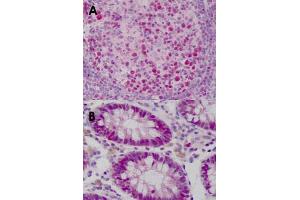 Immunohistochemical staining (Formalin-fixed paraffin-embedded sections) of human tonsil (A) and human colon (B) with WDHD1 monoclonal antibody, clone 20G10  at 15 ug/mL working concentration. (WDHD1 Antikörper  (C-Term))