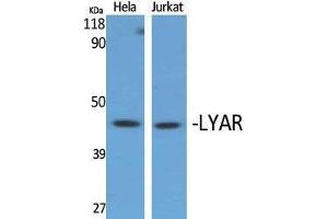 Western Blotting (WB) image for anti-Ly1 Antibody Reactive (LYAR) (Internal Region) antibody (ABIN3175884) (LYAR Antikörper  (Internal Region))