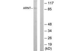 Western blot analysis of extracts from HepG2 cells, using ARNT Antibody. (ARNT Antikörper  (AA 31-80))