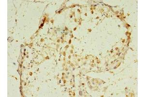 Immunohistochemistry of paraffin-embedded human testis tissue using ABIN7153777 at dilution of 1:100